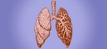Przewlekła obturacyjna choroba płuc - objawy, przyczyny, leczenie