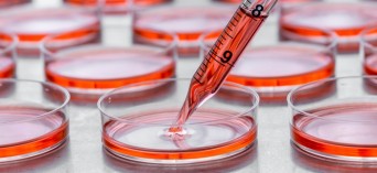 Bank tkanek skórnych - polscy naukowcy pracują nad technologią bezbliznowego gojenia ran