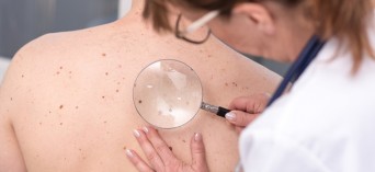 Program profilaktyki raka skóry dla mieszkańców województwa lubelskiego