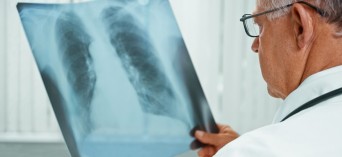 Zamość: bezpłatne badania w kierunku raka płuc