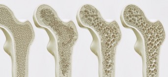 Woj. pomorskie: Osteobus - bezpłatne badanie kości
