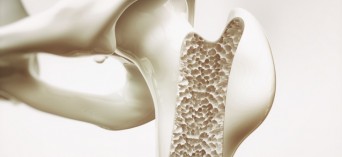 Bezpłatne badania słuchu oraz w kierunku osteoporozy w dwóch powiatach