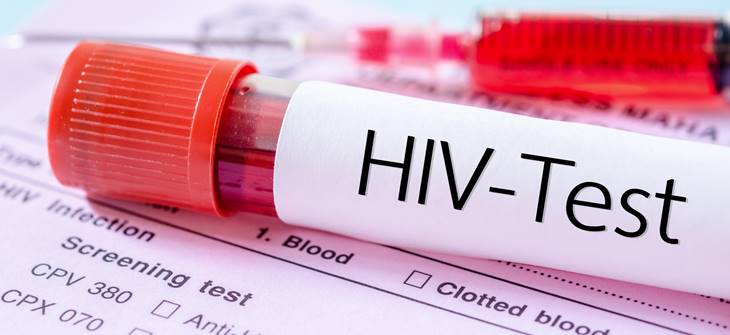 Warszawa bezplatny test na HIV