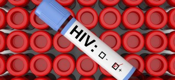 Łódź: bezpłatne badania w kierunku HIV
