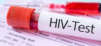 Warszawa: bezpłatne i anonimowe testy na HIV 
