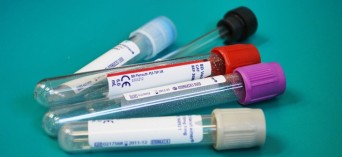 Chełm: bezpłatne badania profilaktyczne krwi