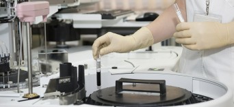 Czujnik chemiczny wykryje pierwsze oznaki raka - pracują nad nim polscy naukowcy