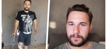 Ocalić Kamila przed amputacją - mamy czas tylko do końca września!