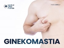 Ginekomastia – męski problem, który rozwiąże chirurgia plastyczna