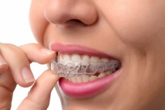 Aparat na zęby dla dorosłych? Może Ci się przydać bardziej, niż myślisz!