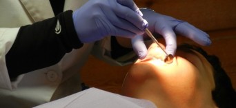 Implanty zębowe - jakie są przeciwwskazania?