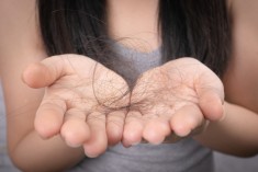Łysienie to już nie problem - poznaj przeszczepy włosów FUE